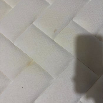 Yatakta Lekelenme, Garanti Kapsamı Belirsiz Ve 1500 TL Ücret Talebi