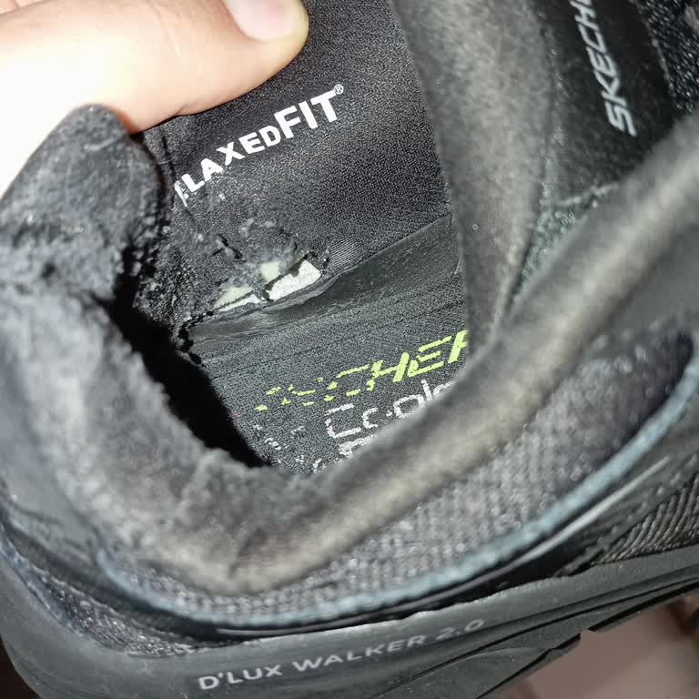 Kısa Sürede Bozulan Skechers Ayakkabısı Ve Boyner Mağazasının İlgisiz Tutumu