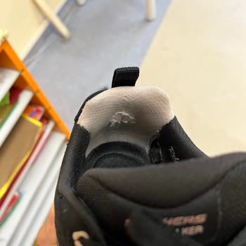 Skechers Ayakkabısında Kısa Sürede Yırtılma Ve Topuk Soyulması, Kullanıcı Hatası İddiası