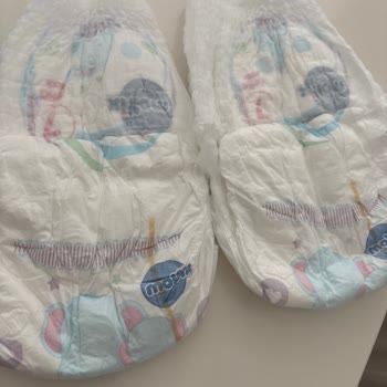 Molfix Külot Bezlerinde Baskı Hatası Ve Bel Kısmının Erken Kopması