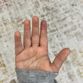 Çocuğuma Elektrik Çarpması Yapan Buhar Makinesi İçin Acil Değişim Ve Güvenlik Talebi