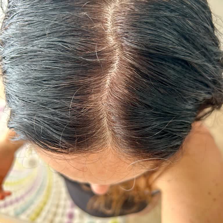 L’Oréal 5.15 Saç Boyası Kapsamı Sağlamadı, 20 Kutunun Değişimi Reddi