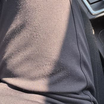 Osyho Pantolonunda Erken Tüylenme Ve İade Talebine Cevapsızlık