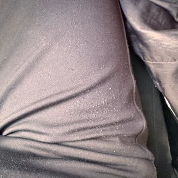 Osyho Pantolonunda Erken Tüylenme Ve İade Talebine Cevapsızlık