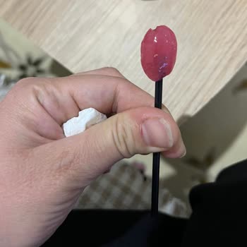 Rocco Şeker Çubuğunda Keskin Kırık Parça Çocuğun Diline Zarar Verdi