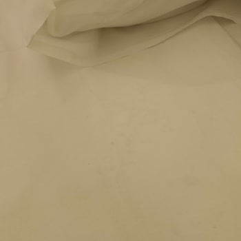 Obilet'te Yanıltıcı Otel Görselleri, Temizlik Ve İade Sorunları