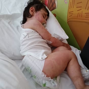 Yeni Med Tıp Merkezi’nde Klamoks İlacı Çocuğumun Hayatını Tehlikeye Attı