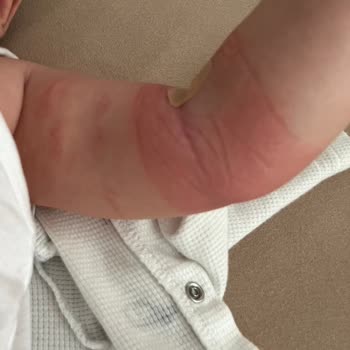 Medipol Mega Hastanesi'nde Bebek Kan Alımında Yaşanan Ağır Acı Ve Dikkatsiz Uygulama