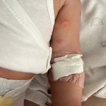 Medipol Mega Hastanesi'nde Bebek Kan Alımında Yaşanan Ağır Acı Ve Dikkatsiz Uygulama