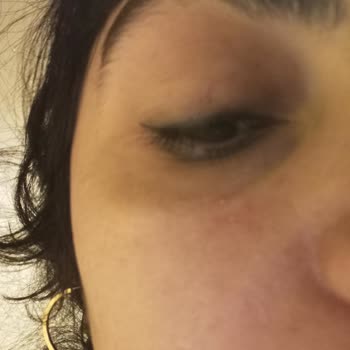 Elidor Pembe Şampuanı Ciltte Yanma Ve Sivilcelere Neden Oldu Müşteri Hizmetleri Cevap Vermedi