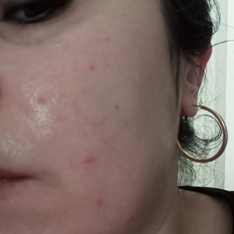 Elidor Pembe Şampuanı Ciltte Yanma Ve Sivilcelere Neden Oldu Müşteri Hizmetleri Cevap Vermedi