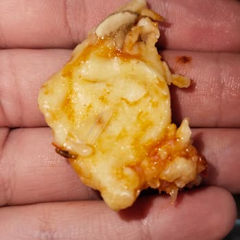 Domino’s Şubesinde Pizza’da Cam Parçası Keşfedildi