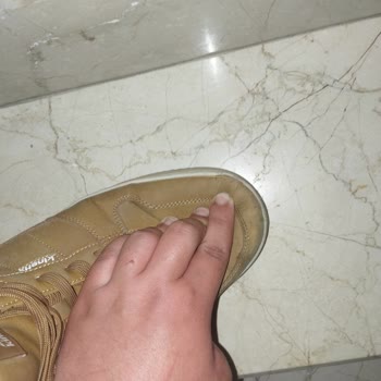 Kısa Sürede Açılan Ayakkabı, Kalite Sorunu Ve İade Talebi