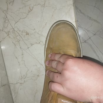 Kısa Sürede Açılan Ayakkabı, Kalite Sorunu Ve İade Talebi