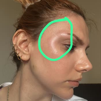 Pure Klinik Mağduriyet Yaşama