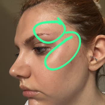 Pure Klinik Mağduriyet Yaşama