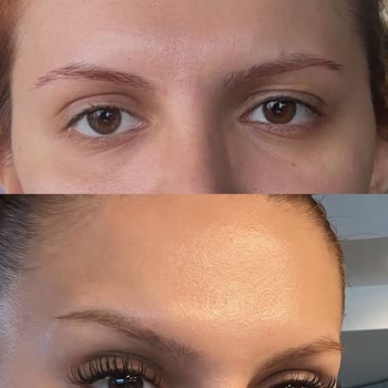 Pure Klinik Mağduriyet Yaşama