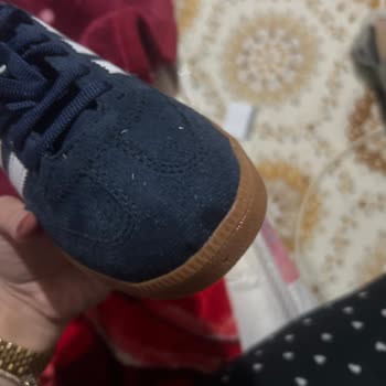 Yanlış Renk Ve Açılmış Kenarlı Adidas Ayakkabıda Satıcıdan Cevap Yok