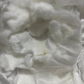 Sleepy Bebek Bezlerinde Sürekli Sızdırma Ve Müşteri Hizmetlerine Ulaşılamama