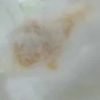 Sleepy Bebek Bezlerinde Sürekli Sızdırma Ve Müşteri Hizmetlerine Ulaşılamama