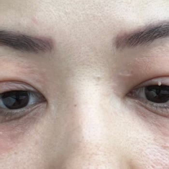 Peripera Rimeli Ve Clio Concealer'dan Alerjik Ve Milia Sorunları