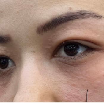 Peripera Rimeli Ve Clio Concealer'dan Alerjik Ve Milia Sorunları