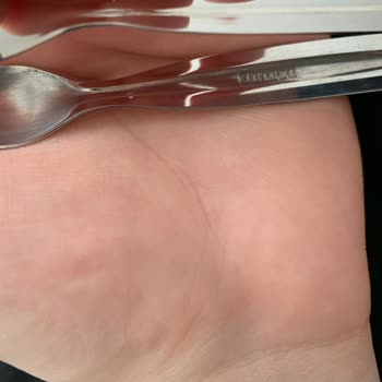 Defolu Karaca Ürünleri Ve Müşteri Hizmetlerinde Tutarsızlık