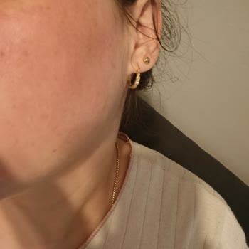 Isana Yüz Maskesi Uygulamasında Şiddetli Yanma Ve İade Talebi