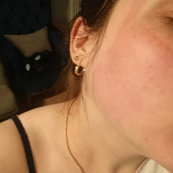 Isana Yüz Maskesi Uygulamasında Şiddetli Yanma Ve İade Talebi