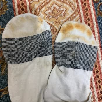 Çorapları Boyayan Ayakkabılar İçin İade Ve Tazminat Talebi