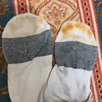 Çorapları Boyayan Ayakkabılar İçin İade Ve Tazminat Talebi