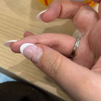 Behka Nail'de Deneyimsiz Uzman Nedeniyle Ağrılı Ve Zarar Görmüş Tırnaklar, Söz Verilen Düzeltme Yok