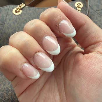 Behka Nail'de Deneyimsiz Uzman Nedeniyle Ağrılı Ve Zarar Görmüş Tırnaklar, Söz Verilen Düzeltme Yok