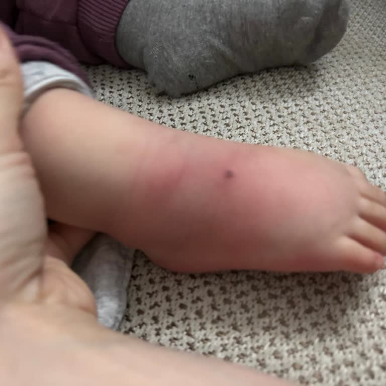 Bebeğimin Ayağında Serum Sızıntısı Nedeniyle Şişlik Ve Ağrı, Bilgilendirme Eksikliği Ve Haksız 3000 TL Ücret Talebi