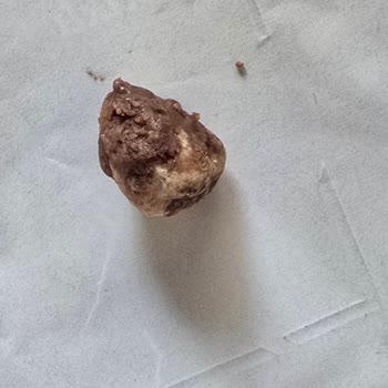 Torku Çikolatasındaki Taş Benzeri Madde Dişimi Kırdı Ve 80 Bin TL Tedavi Masrafı Talep Ediyorum