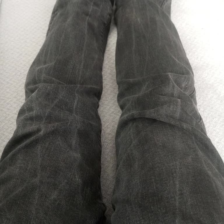 İlk Yıkamada Beliren Beyaz Çizgiler Ve Mağazanın Müşteri Hatası İddiası