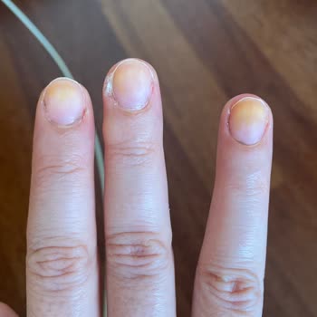 Flormar Ojesinin Tırnaklarda Sarı Turuncu Lekeler Bırakması