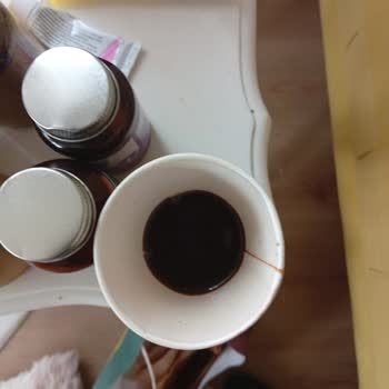 Teslimatta Dökülen Espresso Ve İade Butonu Olmaması