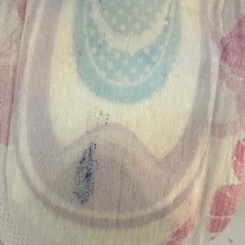 Orkid Platinum Hijyenik Pedde Kimyasal Lekesi Ve Eksik Paketleme Sorunu