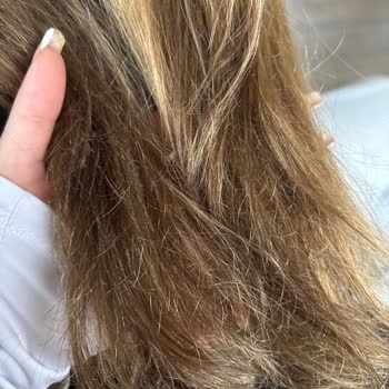 Randevu Saatinde Bekletilme Ve Saç Hasarı Nedeniyle 9.000 TL'lik Ücret İçin Mağduriyet