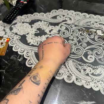 Yanlış Kan Alımı Sonrası Şiddetli El Şişliği Ve Ağrısı