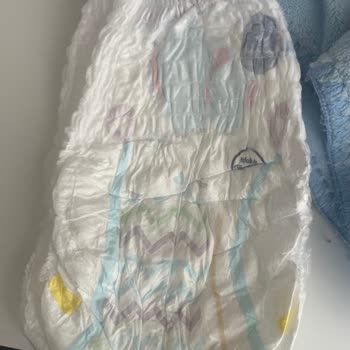 Molfix Külot Bezinin Erken Sızıntısı Bebeği Islatıyor