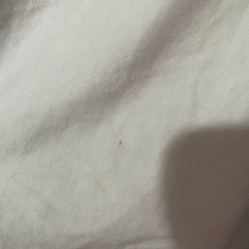 Pull & Bear T-Shirt'inde Kırmızı İp Ve Leke