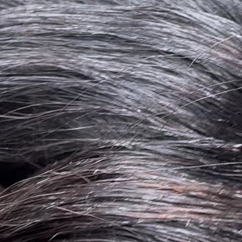 Syoss Max Hold Mousse Saçta Pul Pul Kalıntı Sorunu