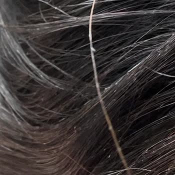 Syoss Max Hold Mousse Saçta Pul Pul Kalıntı Sorunu