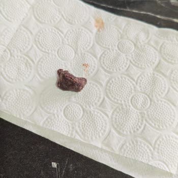 Kellogg’s Cocopops Cerezinde Kahvaltıya Tehdit Eden Taş Gibi Yabancı Madde