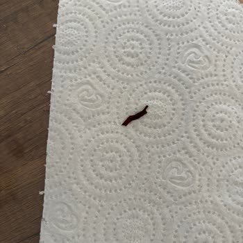 Bolçi Çikolatasında Çocuğa Gelen Tehlikeli Plastik Parça