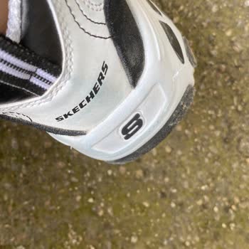 Skechers Ayakkabısında Çıkarılamayan Mavi Lekeler Ve İade Talebi