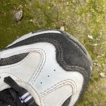 Skechers Ayakkabısında Çıkarılamayan Mavi Lekeler Ve İade Talebi