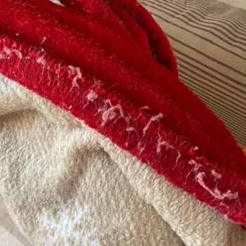 Battaniyenin Aşırı Tüy Dökmesi Ve Müşteri Hizmetlerinin Cevapsızlığı